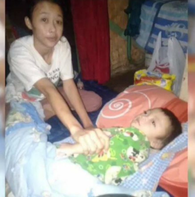 
 Ditengah Serba Keterbatasan, “Juwita” Penderita Meningitis Atau Radang Selaput Otak Memerlukan Uluran Tangan Kita Semua