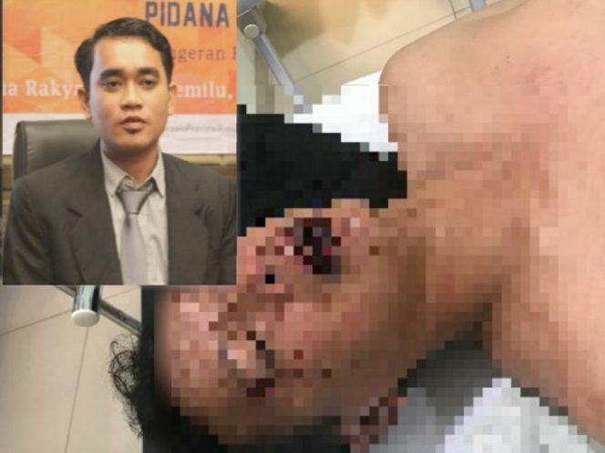 
 Diduga Anak Bupati Rohil Aniaya Warga, Ini Kata Ahli Hukum Pidana