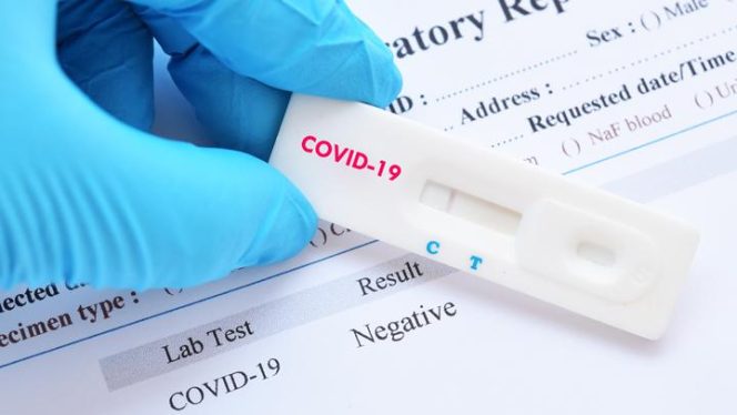 Sebanyak 1.000 Orang di Langsa Akan di Rapid Test Massal Covid-19