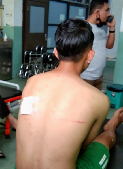 
 Insiden Pra Pora, Atlet Sepak Bola Aceh Tamiang Ditikam di Bagian Punggung sebelah Kiri