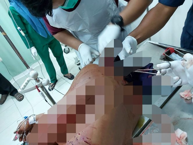 
 Insiden Ternak Berujung Duel, Seorang Warga Aceh Timur Alami Luka Bacok Dirujuk ke RSUZA